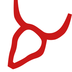 Al