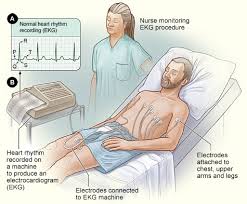 ekg